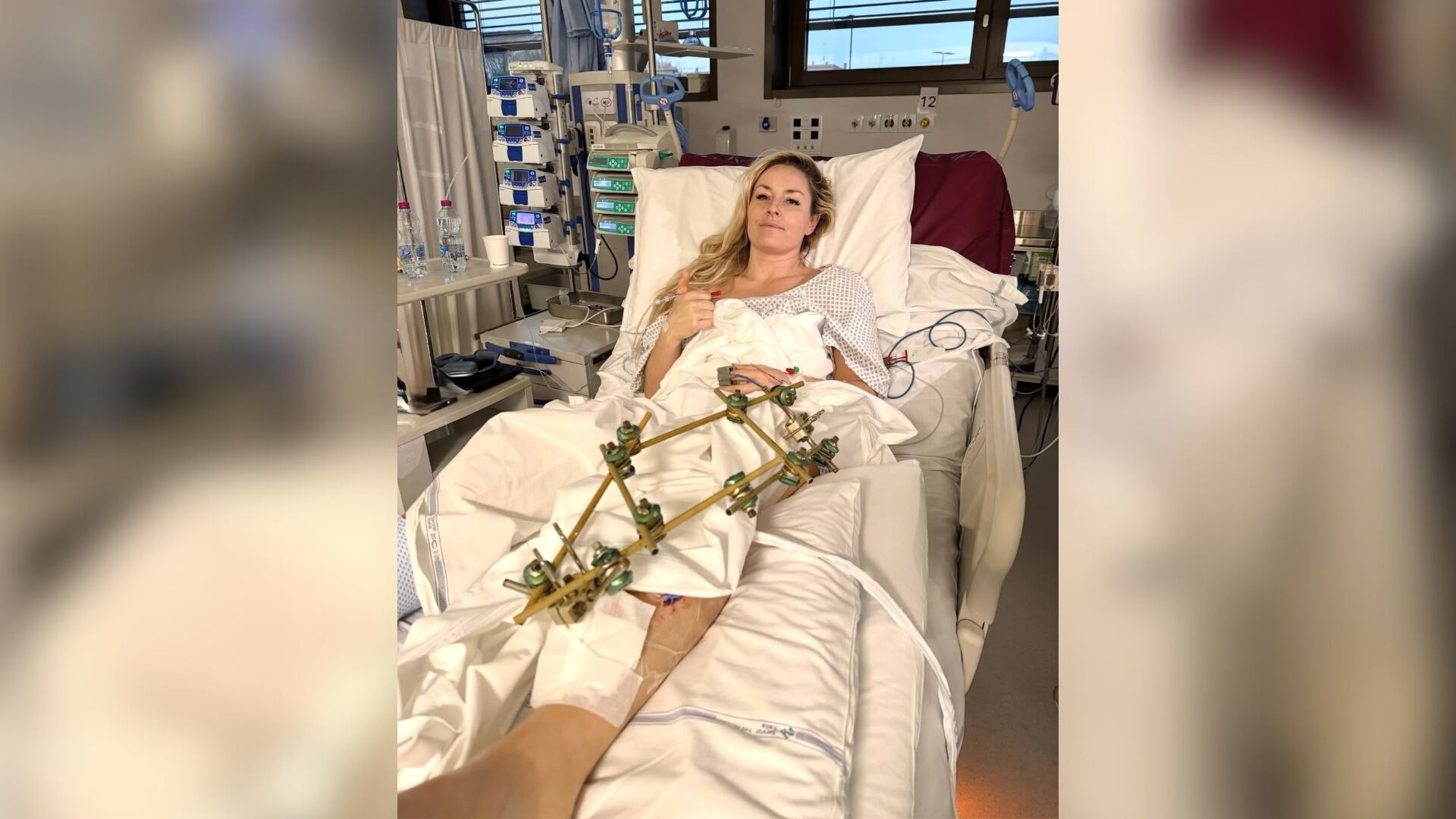 Lindsey Vonn shares photos from hospital bed after 'successful' 3rd surgery  on broken leg