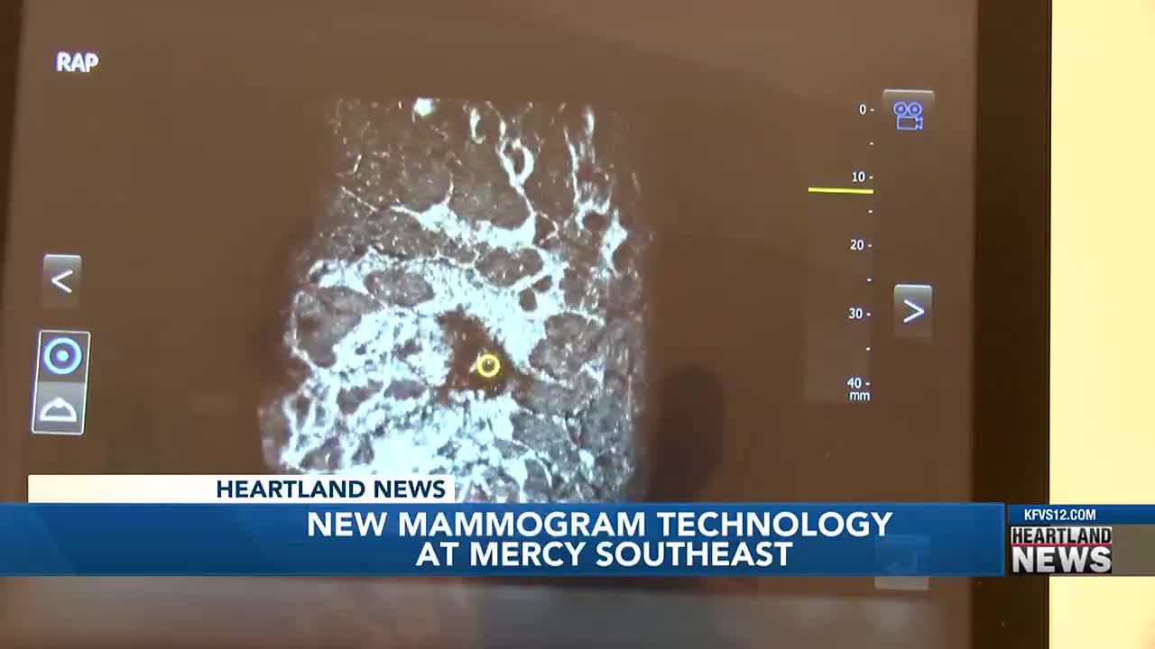 Cape Girardeau hospital introduces automated breast ultrasound to